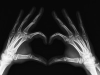 x-ray-heart